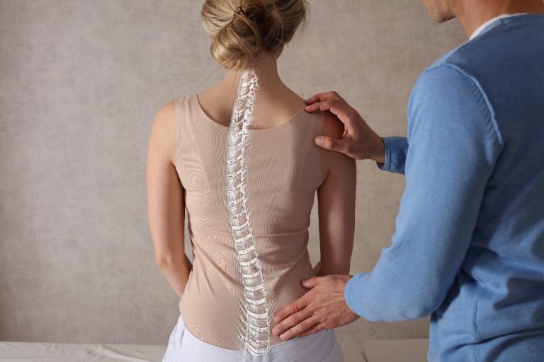 Escoliose: diagnóstico precoce evita cirurgia em 70% dos casos