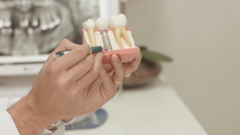 Especialista explica e aponta vantagens do tratamento com implantes dentários