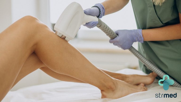 Depilação a laser: novas tecnologias  removem pelos sem dor