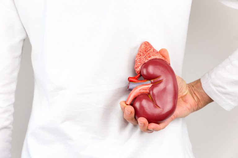 Clima aumenta incidência de casos de cálculo renal