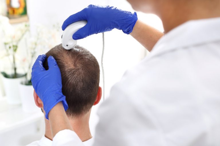 Queda de cabelo afeta a autoestima: tratamentos clínicos na tricologia são opção