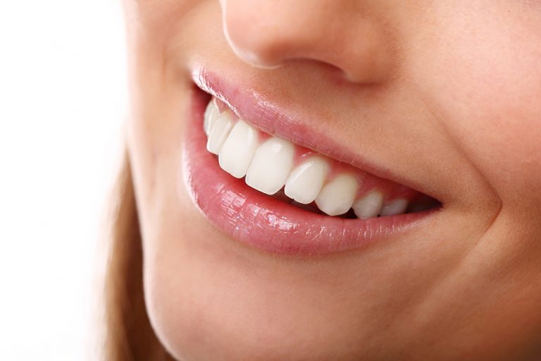 Excesso de gengiva no sorriso causa insatisfação entre brasileiros