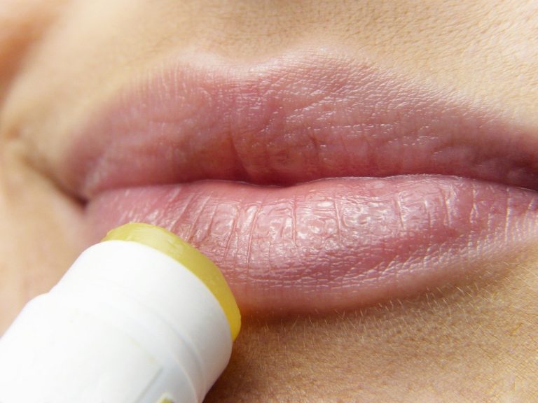 Internet é o recurso preferido pelos pacientes para saber mais sobre herpes