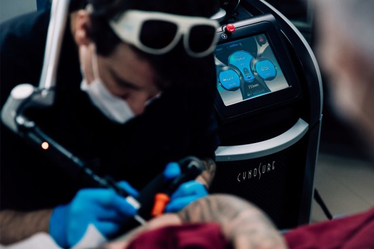 Remoção de tatuagens exige cuidados especiais
